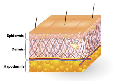 A diagram of skin