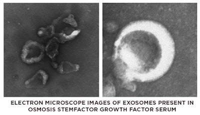 The breakthroughs in formulating StemFactor include creating the perfect environment to stimulate growth factor production from both human stem cells and fibroblast cells. Our unique formula does not use human stem cells, but the growth factors they produce. For the last 15 years, most skin care lines use individual growth factor ingredients like Epidermal Growth Factor (EGF) that are made from bacteria. The results are less stable, less active and less plentiful numbers of growth factors. It has also been proven unhealthy for the skin to only use one of the 300 varieties of growth factors because it creates an imbalance. Using human stem cells and fibroblasts allows us to add virtually all of the varieties the skin needs, but this new formula is much more than that. In our bodies, when stem cells make these powerful healing tools, they encase them in a protective and penetration-enhancing shell called an exosome (pictured here). Whereas most formulas do not have the technology to create them, we are thrilled to be able to feature exosome technology for powerful results.