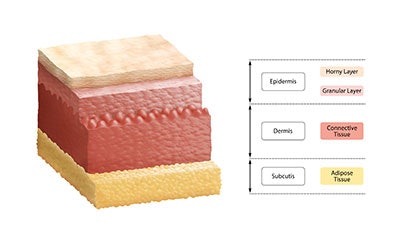 Skinlayers3