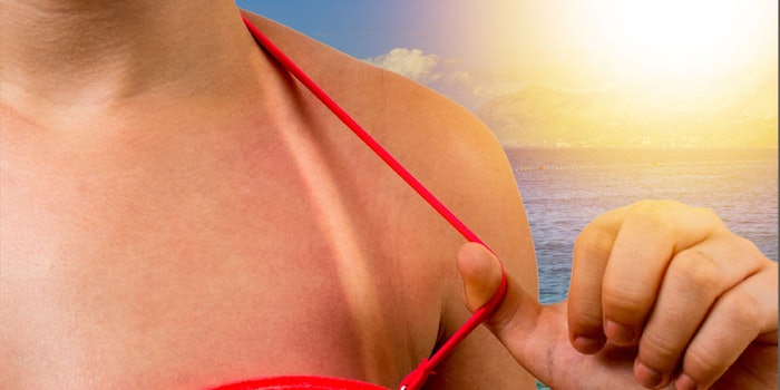 Sunburn_noParallaxTemplate