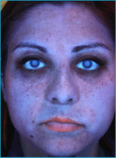 Image Analysis of Pigment After