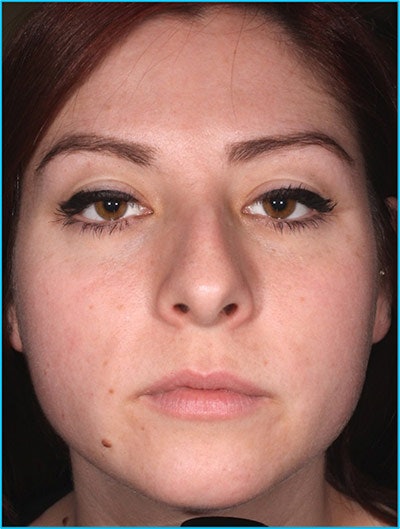 Case Study Client After