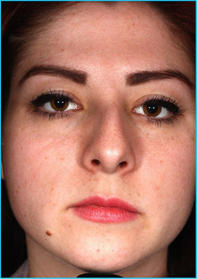 Case Study Client Before