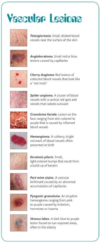 Si1712 Vascular Sidebar 500