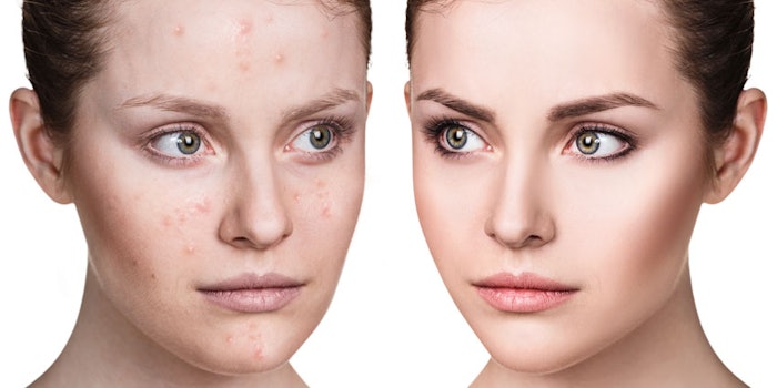 Skin_Positivity_np