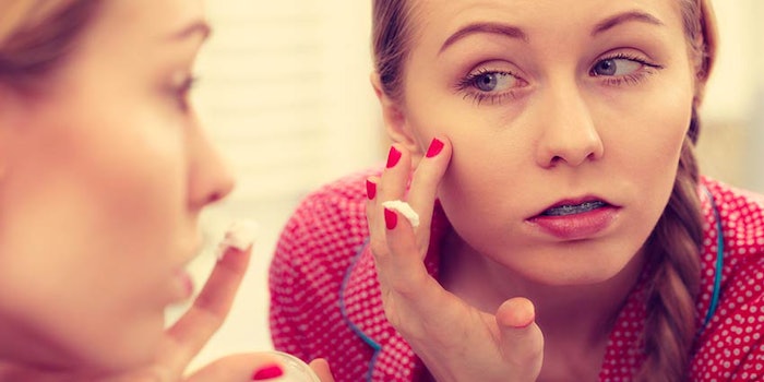 850x425_topical-acne