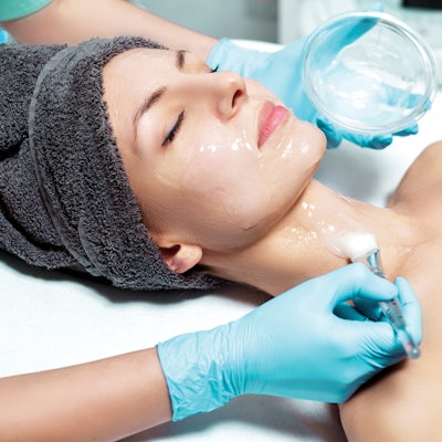 facial-peel