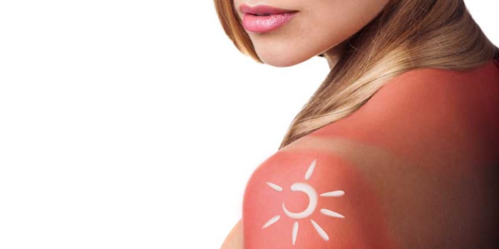 Sunburn_np