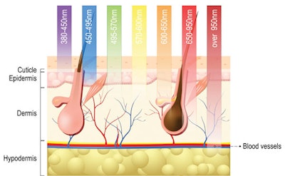 Si1805 Then Now Dream 84001212 Skin Diagram 600