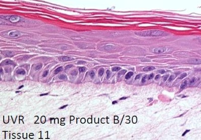 The information above is an example of preventing genetic damage and preserving healthy DNA epigenetically by using sunscreen.