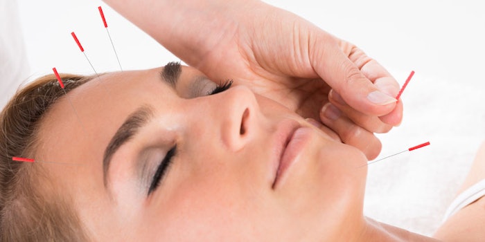 acupuncturefacelift_np1