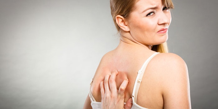 bodyacne_np1