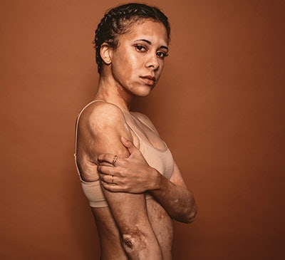 Si1807 Color Dream 105110957 Vit 400