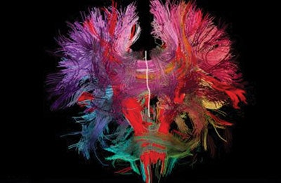 Sisi1807 Decisions Brain Connections 400