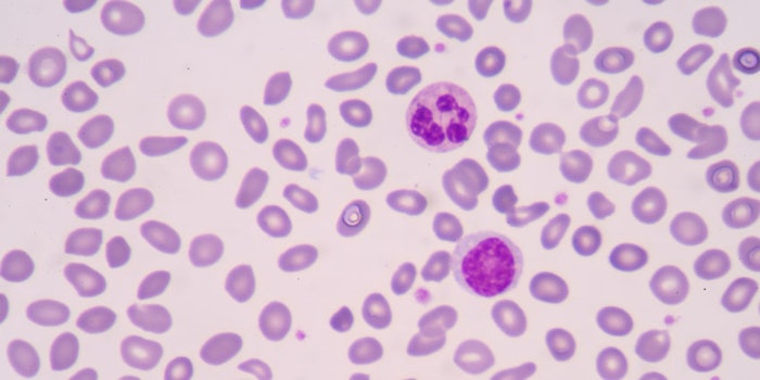 manvsmachineskincancerstudy_np