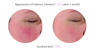 SENSITIVE MASQUE– S.O.S. mask. Non-comedogenic, hypoallergenic