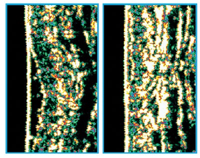 Si1809 Customized Ultrasound Before After Ultra Sound 4001
