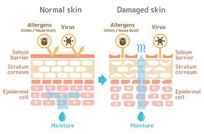 Si1809 Customized Normal V Sdamaged Skin 400