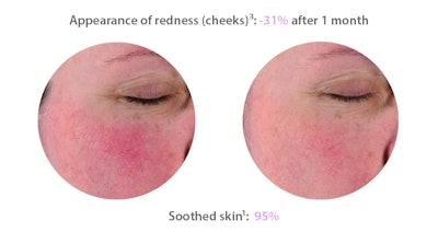 SENSITIVE MASQUE– S.O.S. mask. Non-comedogenic, hypoallergenic