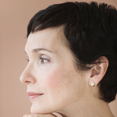 hyperpigmentation-products