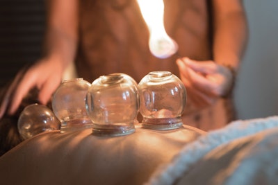 four-moons-Fire-Cupping
