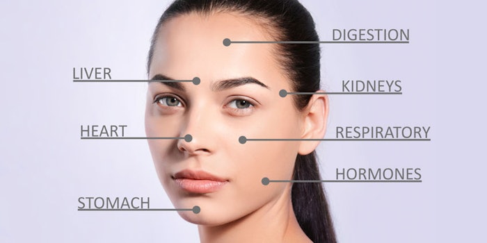 acne diagram of the face