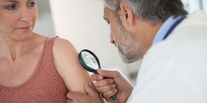 squamoscellcarcinomatherapy_np