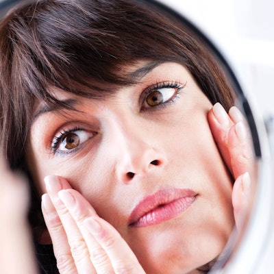 Chemical-Peels-Undereye