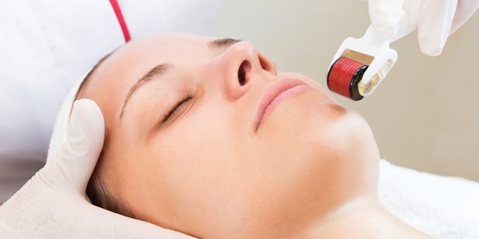 SI1909_microneedling_dreamstime_xxl_102235509_microneedlingFace_850_np