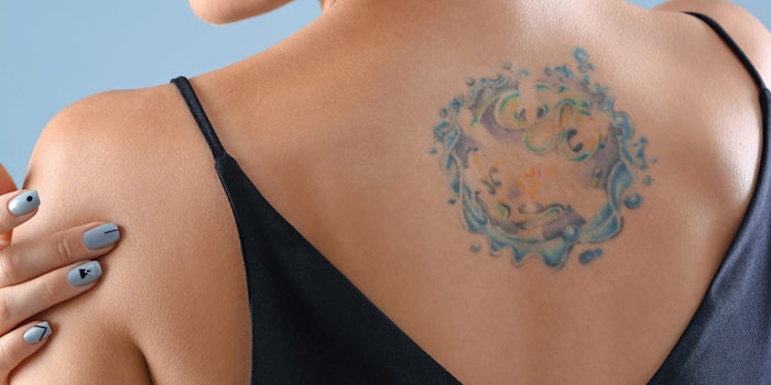 SI1911_trends_dreamstime_xxl_140208805tattooRemoval_850_np