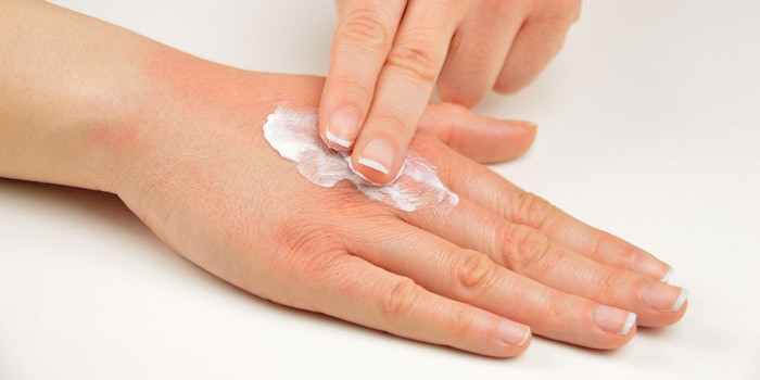 ApplyingLotionIrritatedHandsSkin_850x425