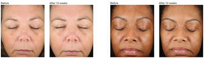 It is time to expect more from your antioxidant. Learn more about PCA SKIN®’s innovative C&E Advanced formula, and their new C&E Hand Renewal, formulated specifically for the delicate skin of the hands, at pcaskinpro.com/vitaminc.