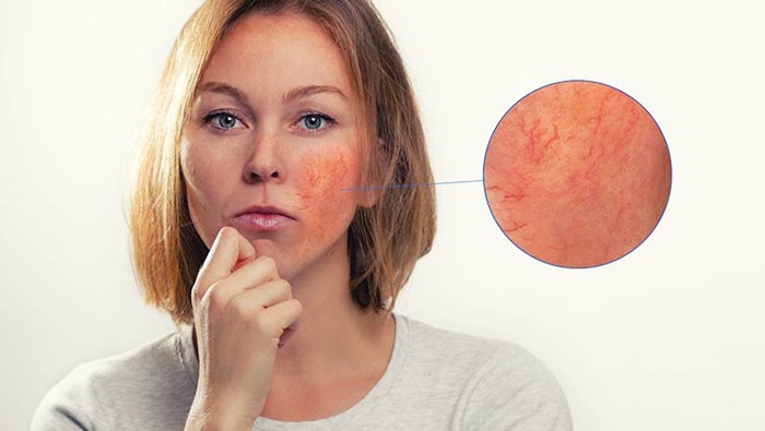 Ds2011 Spotlight Dreamstime Xxl 163259960 850np