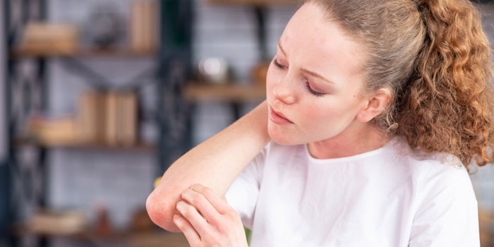 WomanAnnoyedSensitiveSkinItchingElbow850x425
