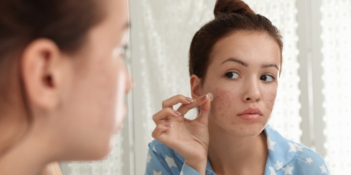 pimple patch