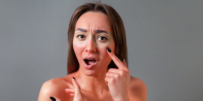 Reactive and sensitive skin can be hard to find a routine for.