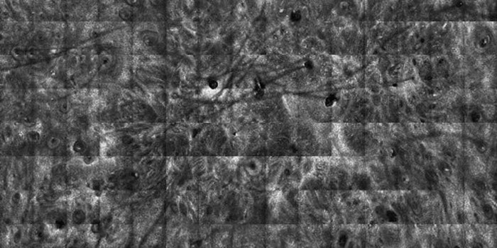 Reflectance_Confocal_Microscopy_nt