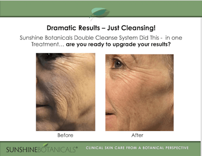 This is what Sunshine Botanicals Double Cleanse System can do after one single treatment – are you ready to upgrade your results?