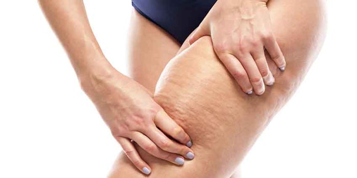 cellulite_np