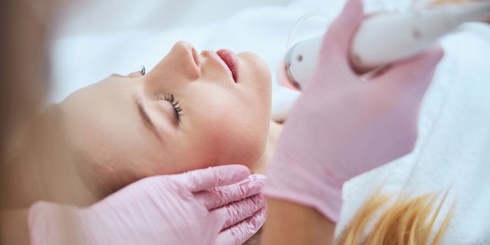 microneedling_np