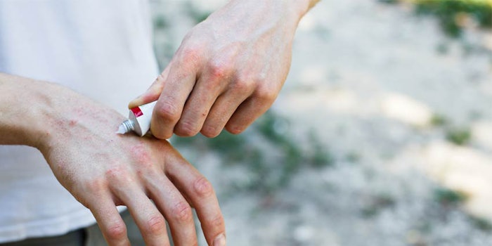 Anthralin is a topical medicine typically used to treat psoriasis. It can be extremely effective as a short contact or overnight treatment, but there are also possible side effects, per Medical News Today.