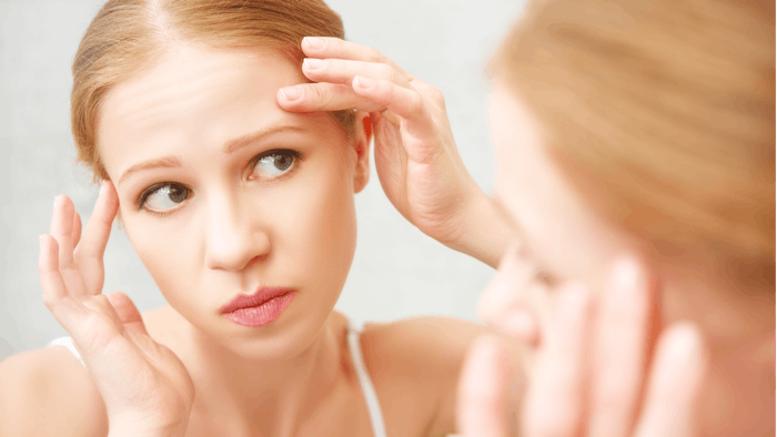High androgen levels can lead to hormonal acne.