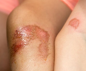 Rhonda Si2202 Element1