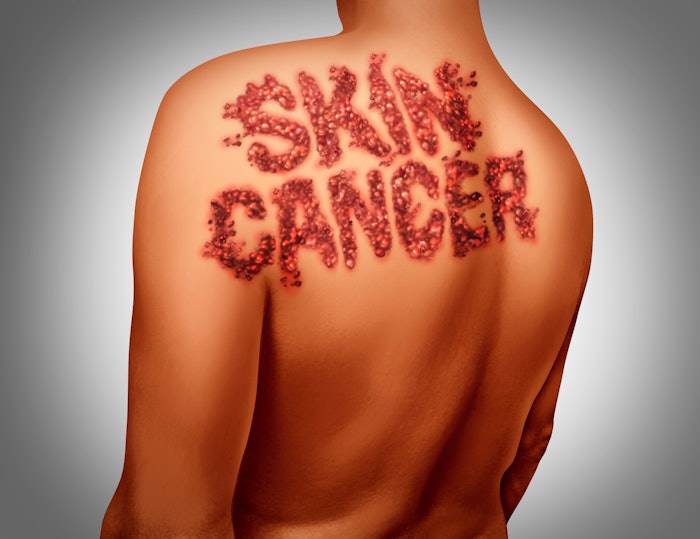 Dreamstime M 67113946