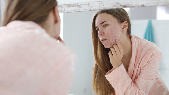 A study from the European Academy of Dermatology and Venereology identified a potential link between acne and omega-3 fatty acids deficiency.