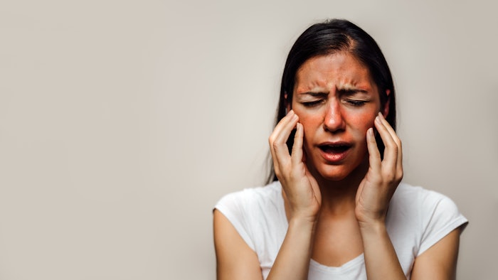 Acid exfoliants, retinoids and other potent ingredients can potentially cause a chemical burn if used improperly.