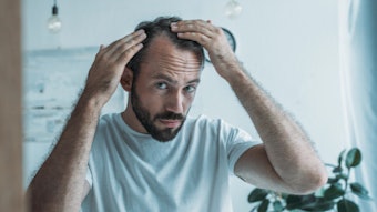 Si2208 Hair Loss Ryan 850x425