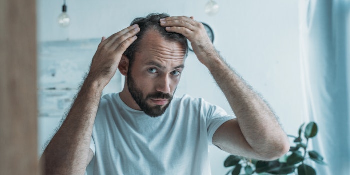 Si2208 Hair Loss Ryan 850x425