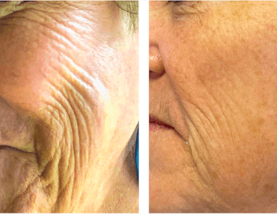 Ginamarie Si2209 Before&after