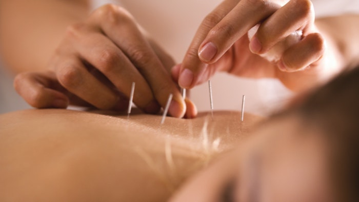 woman receiving acupuncture spa treatment